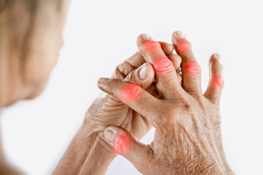 How MIWA Caregivers Assist Clients with Arthritis